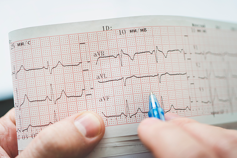 Electrocardiogram health check