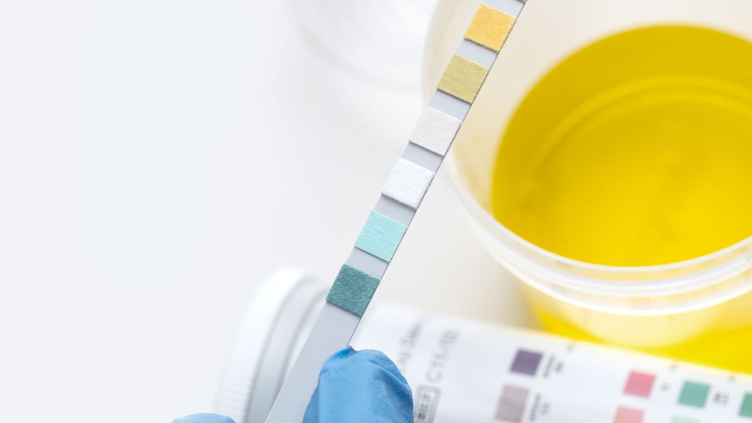 Urine colours